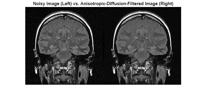 Figure contains an axes object. The hidden axes object with title Noisy Image (Left) vs. Anisotropic-Diffusion-Filtered Image (Right) contains an object of type image.
