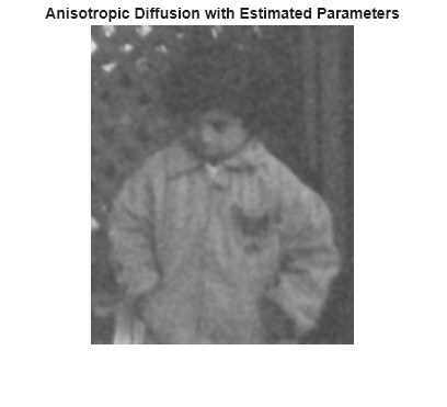 Figure contains an axes object. The hidden axes object with title Anisotropic Diffusion with Estimated Parameters contains an object of type image.