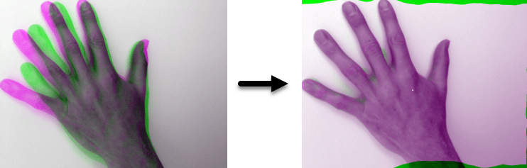 Deformable registration aligns two hands whose fingers are spread to different extents.