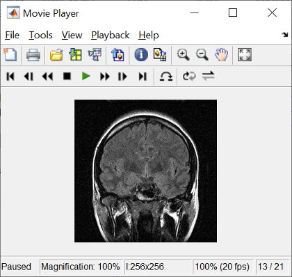 Video Viewer app displaying one frame of a grayscale image sequence, information about the video, and playback controls.