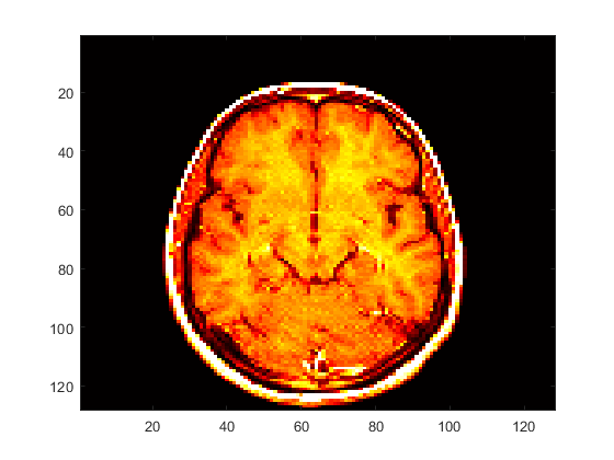 Cross-section of a brain displayed using darker red and yellow colors