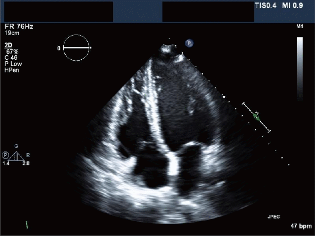 Animation of 2-D cardiac ultrasound exported from app