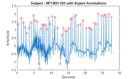 Figure contains an axes object. The axes object with title Subject - MIT-BIH 203 with Expert Annotations, xlabel Seconds, ylabel Amplitude contains 2 objects of type line. One or more of the lines displays its values using only markers