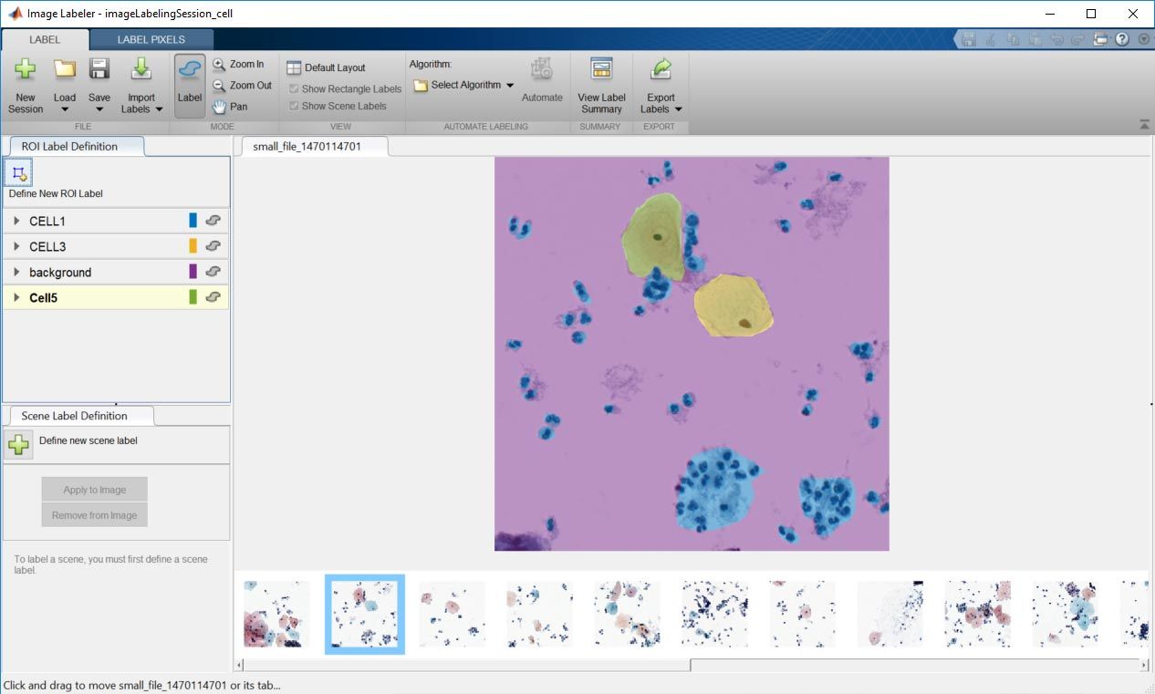 Screenshot of the Image Labeler, displaying cell particles.